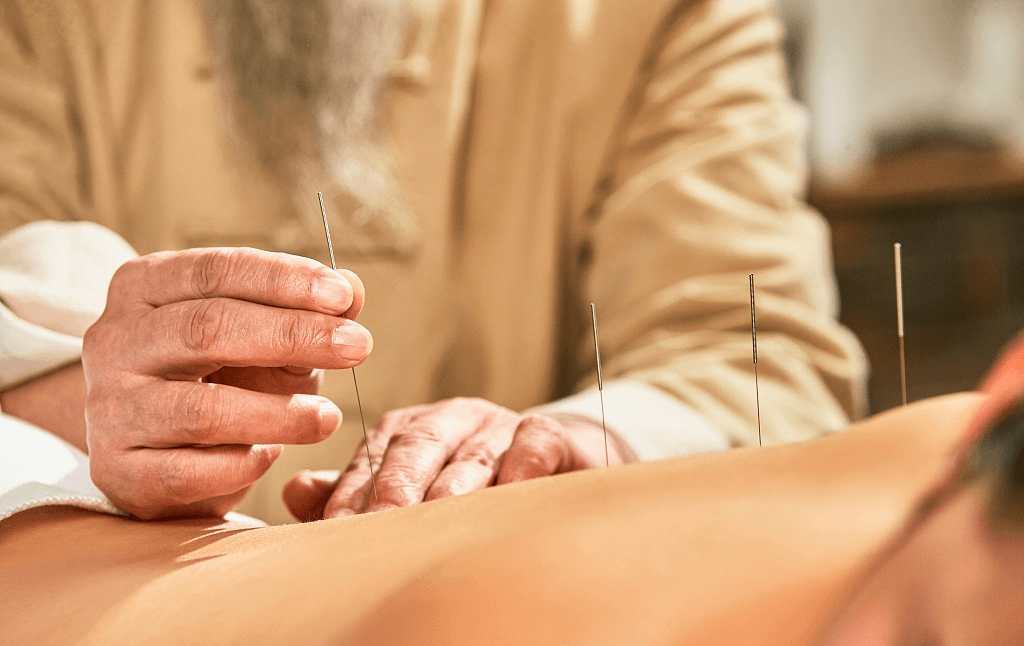 иглоукалывание.jpg иглоукалывание.jpg